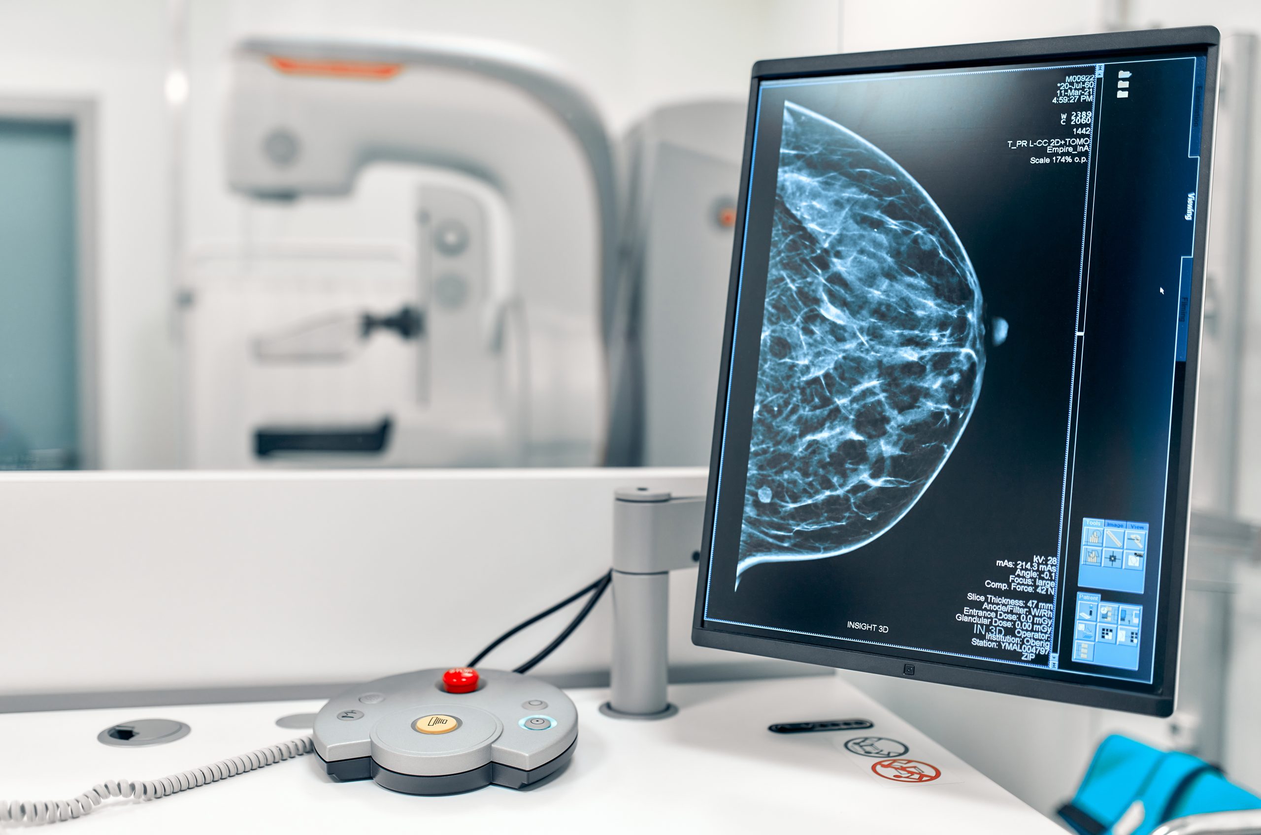 Screening oncologici, ripresa l’attività di refertazione delle mammografie